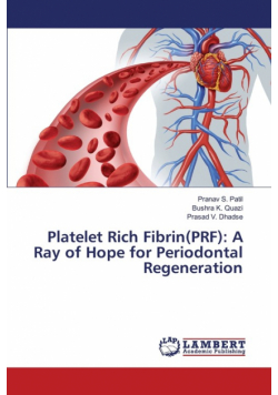 Platelet Rich Fibrin(PRF)
