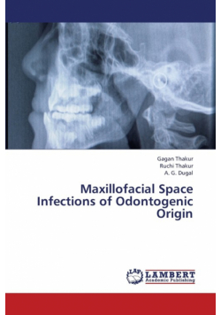 Maxillofacial Space Infections of Odontogenic Origin