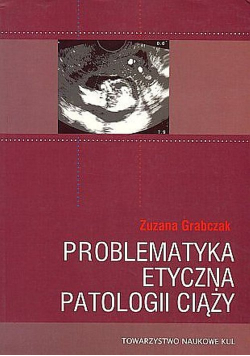 Problematyka etyczna patologii ciąży