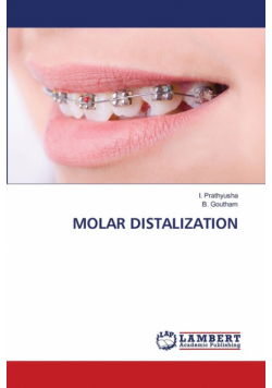 Molar Distalization