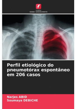 Perfil etiológico do pneumotórax espontâneo em 206 casos