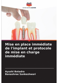 Mise en place immédiate de l'implant et protocole de mise en charge immédiate