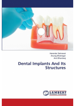 Dental Implants And Its Structures