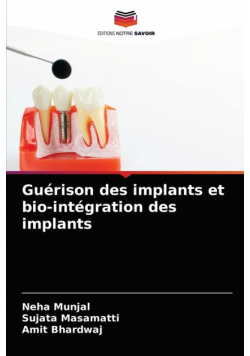 Guérison des implants et bio-intégration des implants
