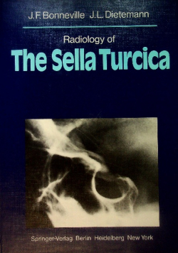 Radiology of the sella turcica