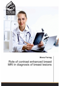 Role of contrast enhanced breast MRI in diagnosis of breast lesions