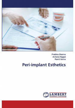 Peri-implant Esthetics