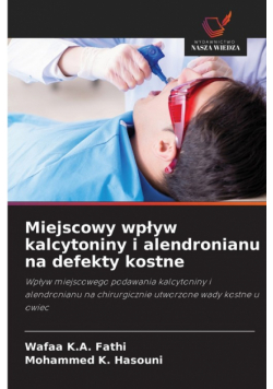 Miejscowy wpływ kalcytoniny i alendronianu na defekty kostne