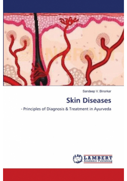 Skin Diseases
