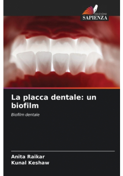 La placca dentale