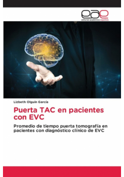 Puerta TAC en pacientes con EVC