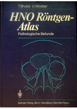 HNO Röntgen-Atlas: Pathologische Befunde