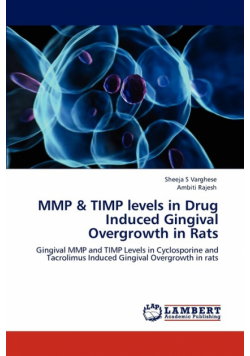 Mmp & Timp Levels in Drug Induced Gingival Overgrowth in Rats