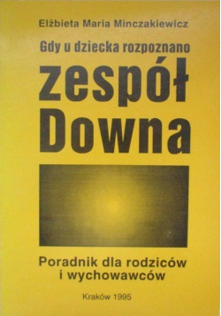Gdy u dziecka rozpoznano zespół Downa