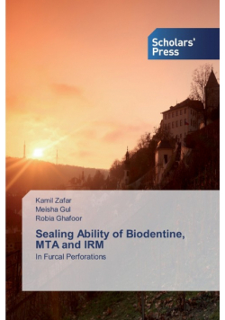 Sealing Ability of Biodentine, MTA and IRM