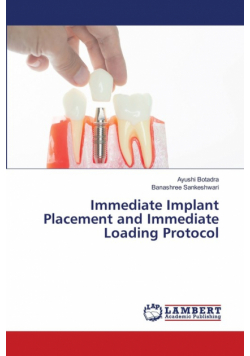 Immediate Implant Placement and Immediate Loading Protocol