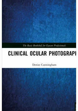 Clinical Ocular Photography