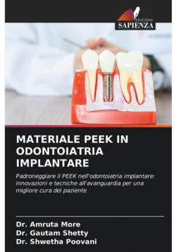 Materiale Peek In Odontoiatria Implantare