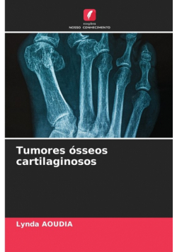 Tumores ósseos cartilaginosos