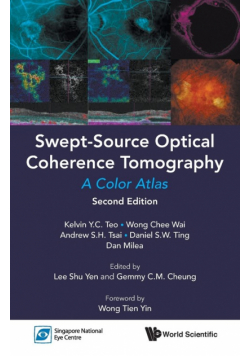 Swept-Source Optical Coherence Tomography