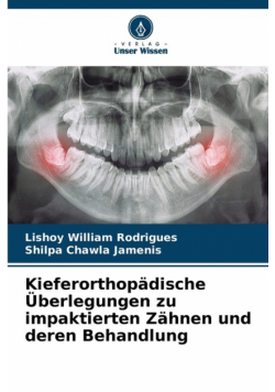Kieferorthopädische Überlegungen zu impaktierten Zähnen und deren Behandlung