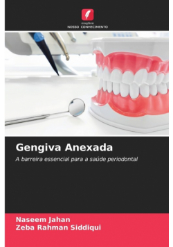 Gengiva Anexada