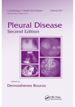 Pleural Disease