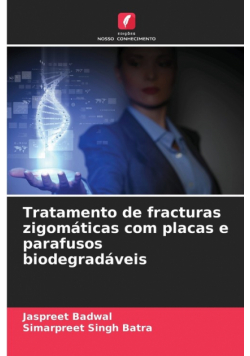 Tratamento de fracturas zigomáticas com placas e parafusos biodegradáveis