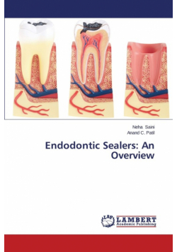 Endodontic Sealers