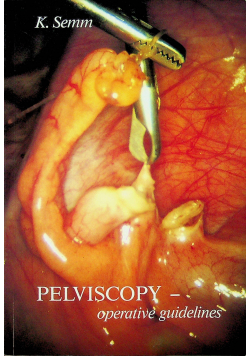 Pelviscopy Operative Guidelines