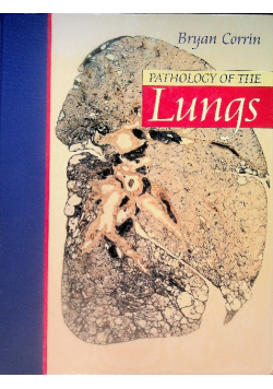 Pathology of the Lungs