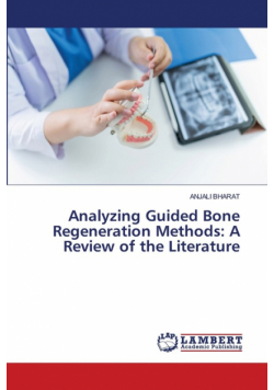 Analyzing Guided Bone Regeneration Methods