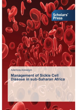 Management of Sickle Cell Disease in sub-Saharan Africa