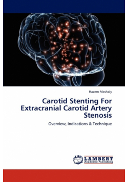 Carotid Stenting For Extracranial Carotid Artery Stenosis