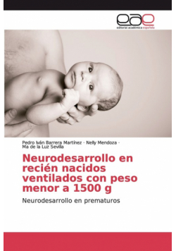 Neurodesarrollo en recién nacidos ventilados con peso menor a 1500 g