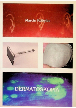Dermatoskopia