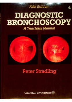 Diagnostic Bronchoscopy: A Teaching Manual