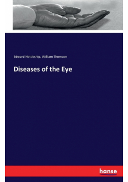 Diseases of the Eye
