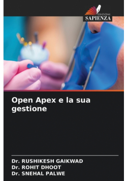 Open Apex e la sua gestione