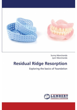 Residual Ridge Resorption