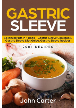 Gastric Sleeve