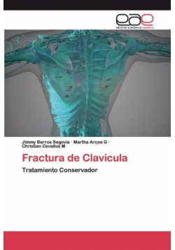 Fractura de Clavicula
