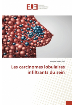 Les carcinomes lobulaires infiltrants du sein