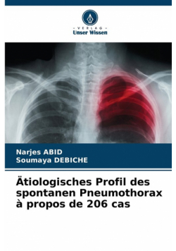Ätiologisches Profil des spontanen Pneumothorax à propos de 206 cas