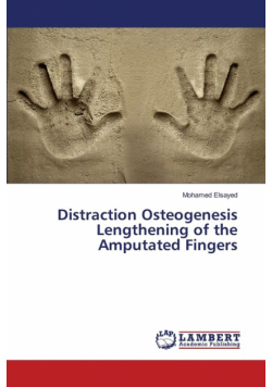 Distraction Osteogenesis Lengthening of the Amputated Fingers