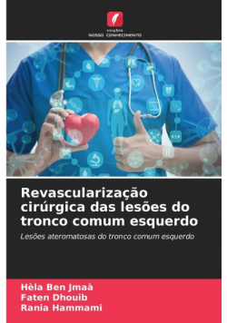 Revascularização cirúrgica das lesões do tronco comum esquerdo