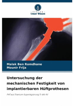 Untersuchung der mechanischen Festigkeit von implantierbaren Hüftprothesen