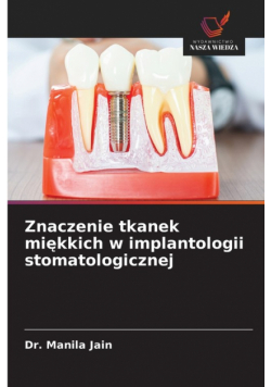 Znaczenie tkanek miękkich w implantologii stomatologicznej