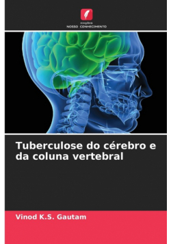 Tuberculose do cérebro e da coluna vertebral
