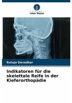 Indikatoren für die skelettale Reife in der Kieferorthopädie